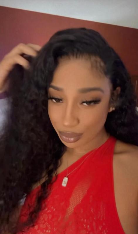 A Vitiligo Dream & Head Doctor